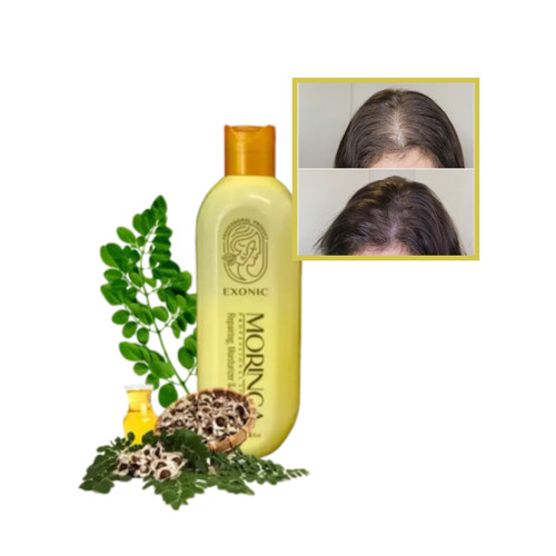 شامپو مورینگا ۳۰۰ml ضد ریزش و کنترل چربی سر (نمایندگی اصلی)