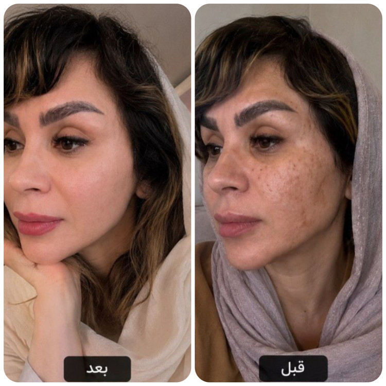 پک تخصصی جوانساز و روشن کننده پوست ویتابلا / تضمین اصالت