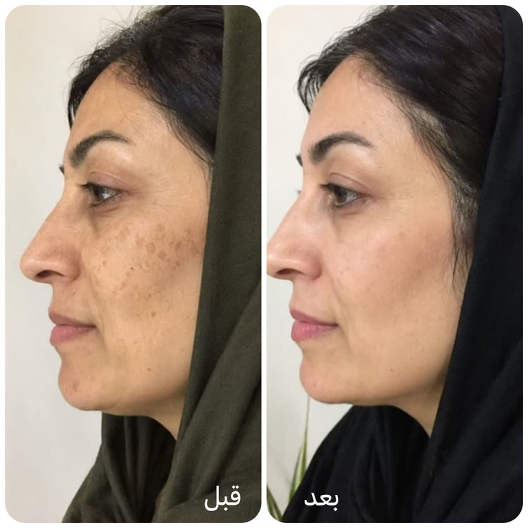 کرم جوانه گندم ویتابلا جوانساز و روشن کننده پوست (نمایندگی اصلی)