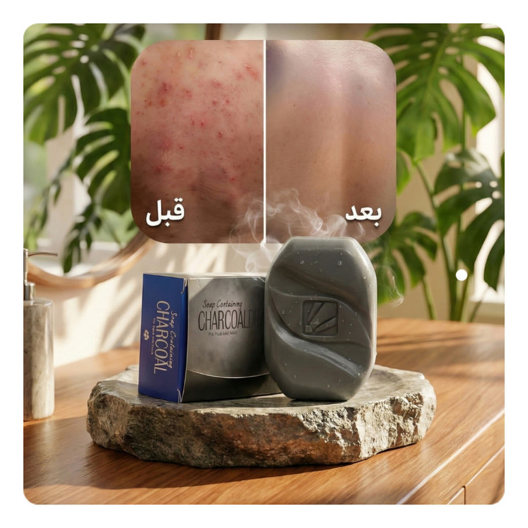 صابون کربن فعال بیز ضدجوش ، ضد لک و روشن کننده پوست
