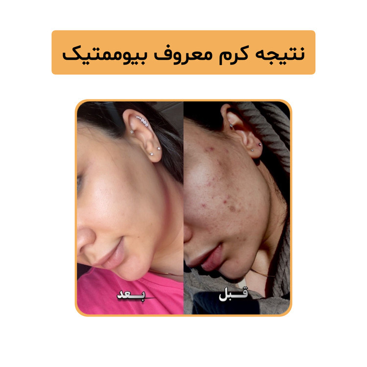 کرم ویتامین c بیوممتیک پنج کاره گاتیو | کاهش لک ،جوانسازی و روشن کننده پوست