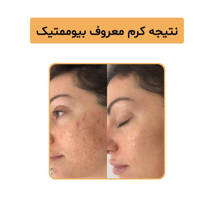 کرم ویتامین c بیوممتیک پنج کاره گاتیو | کاهش لک ،جوانسازی و روشن کننده پوست