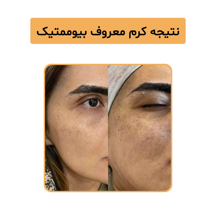 کرم ویتامین c بیوممتیک پنج کاره گاتیو | کاهش لک ،جوانسازی و روشن کننده پوست