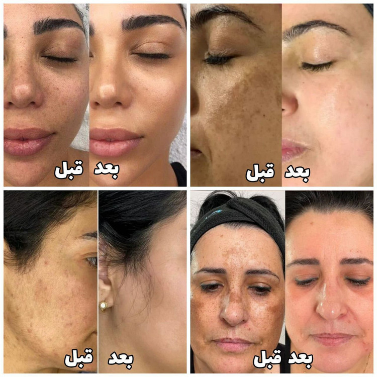 کرم ویتامین c بیوممتیک پنج کاره گاتیو | کاهش لک ،جوانسازی و روشن کننده پوست