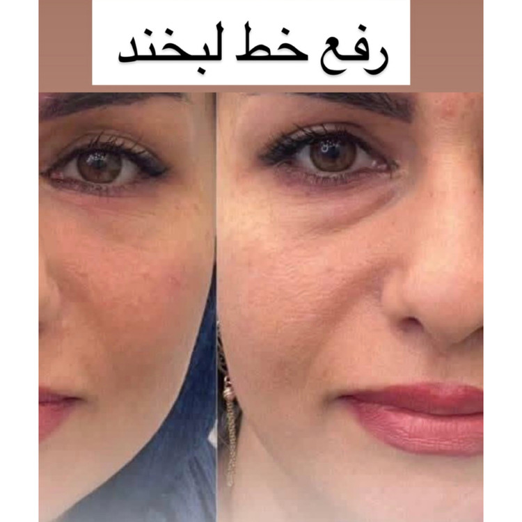 کرم بیوممتیک ضدچین و چروک ۴۰ml گاتیو 5 کاره | جوانسازی ، لیفت کننده و آبرسان | نمایندگی اصلی