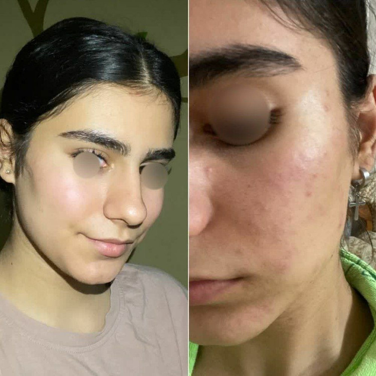 کرم جوانه گندم ویتابلا جوانساز ، ضدلک و روشن کننده پوست