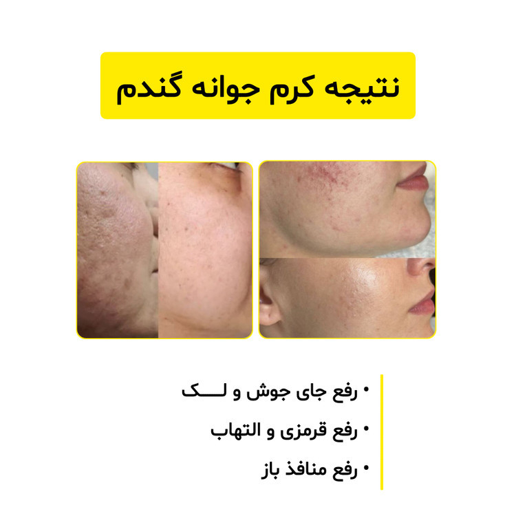 کرم جوانه گندم ویتابلا جوانساز ، ضدلک و روشن کننده پوست