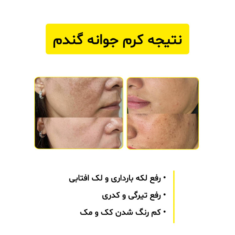 کرم جوانه گندم ویتابلا جوانساز ، ضدلک و روشن کننده پوست