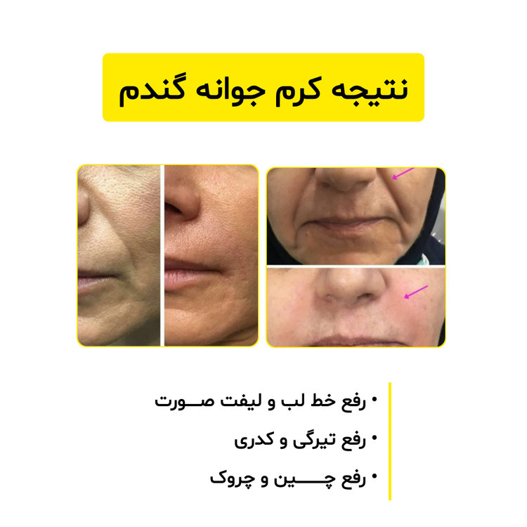 کرم جوانه گندم ویتابلا جوانساز ، ضدلک و روشن کننده پوست